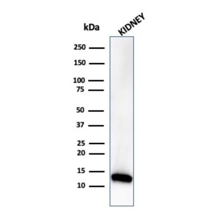 Western Blot - Anti-FABP1 Antibody [FABP1/3485] - BSA and Azide free (A278180) - Antibodies.com