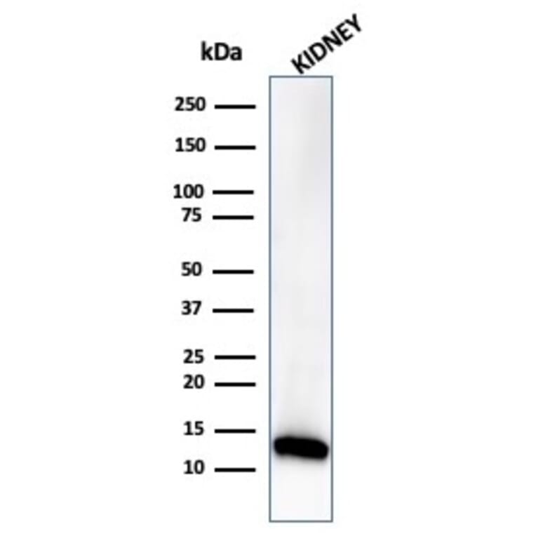 Western Blot - Anti-FABP1 Antibody [FABP1/3485] - BSA and Azide free (A278180) - Antibodies.com