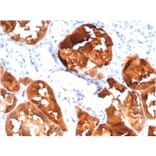 Immunohistochemistry - Anti-FABP1 Antibody [FABP1/3485] - BSA and Azide free (A278180) - Antibodies.com