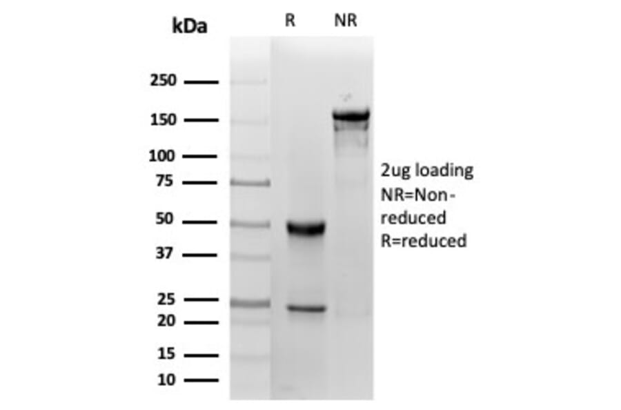 SDS-PAGE - Anti-FABP1 Antibody [FABP1/3485] - BSA and Azide free (A278180) - Antibodies.com