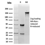 SDS-PAGE - Anti-FABP1 Antibody [FABP1/3485] - BSA and Azide free (A278180) - Antibodies.com