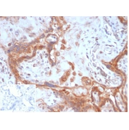 Immunohistochemistry - Anti-Fibroblast Activation Protein alpha Antibody [FAP/4851] - BSA and Azide free (A278182) - Antibodies.com