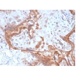 Immunohistochemistry - Anti-Fibroblast Activation Protein alpha Antibody [FAP/4851] - BSA and Azide free (A278182) - Antibodies.com