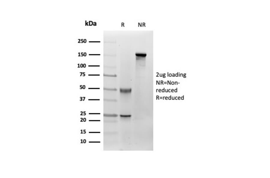 SDS-PAGE - Anti-Fibroblast Activation Protein alpha Antibody [FAP/4851] - BSA and Azide free (A278182) - Antibodies.com