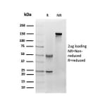 SDS-PAGE - Anti-Fibroblast Activation Protein alpha Antibody [FAP/4851] - BSA and Azide free (A278182) - Antibodies.com
