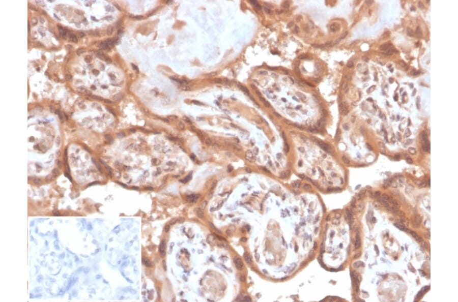 Immunohistochemistry - Anti-Fibroblast Activation Protein alpha Antibody [FAP/4853] - BSA and Azide free (A278183) - Antibodies.com