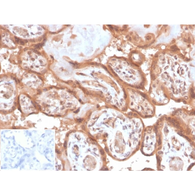 Immunohistochemistry - Anti-Fibroblast Activation Protein alpha Antibody [FAP/4853] - BSA and Azide free (A278183) - Antibodies.com