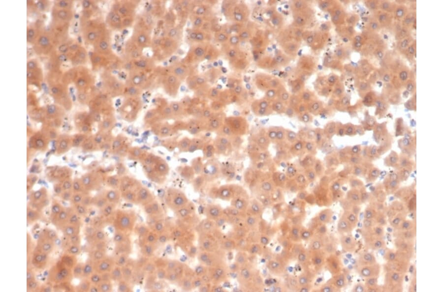 Immunohistochemistry - Anti-Fibroblast Activation Protein alpha Antibody [FAP/4853] - BSA and Azide free (A278183) - Antibodies.com