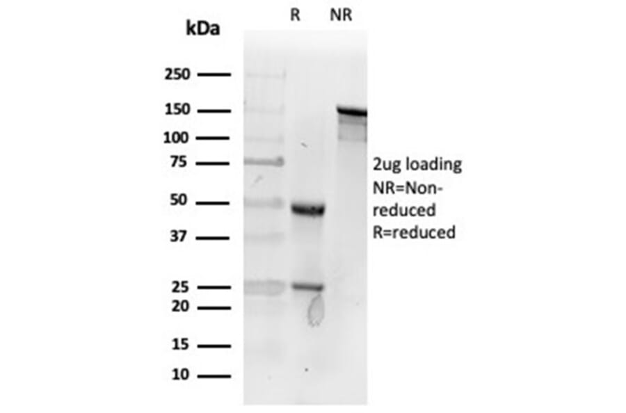 SDS-PAGE - Anti-Fibroblast Activation Protein alpha Antibody [FAP/4853] - BSA and Azide free (A278183) - Antibodies.com