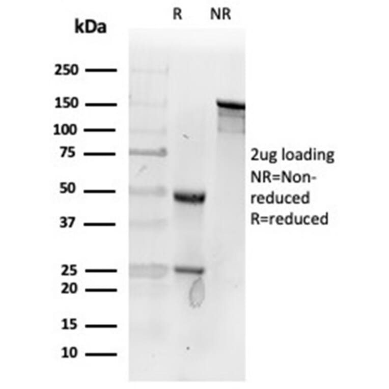 SDS-PAGE - Anti-Fibroblast Activation Protein alpha Antibody [FAP/4853] - BSA and Azide free (A278183) - Antibodies.com