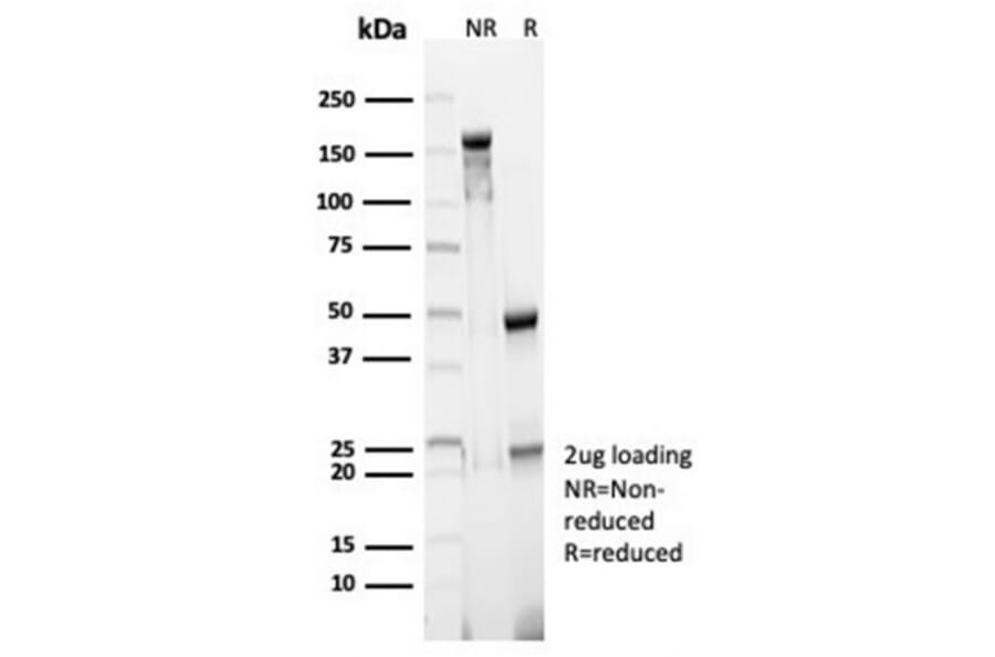 SDS-PAGE - Anti-CD23 Antibody [FCER2/6890] - BSA and Azide free (A278185) - Antibodies.com