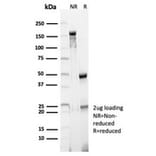 SDS-PAGE - Anti-CD23 Antibody [FCER2/6890] - BSA and Azide free (A278185) - Antibodies.com