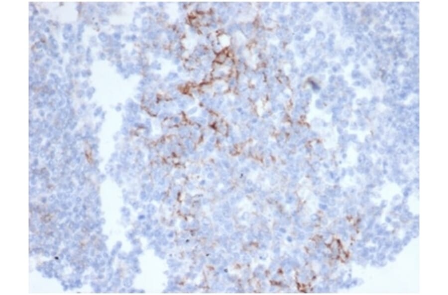 Immunohistochemistry - Anti-CD23 Antibody [FCER2/6890] - BSA and Azide free (A278185) - Antibodies.com