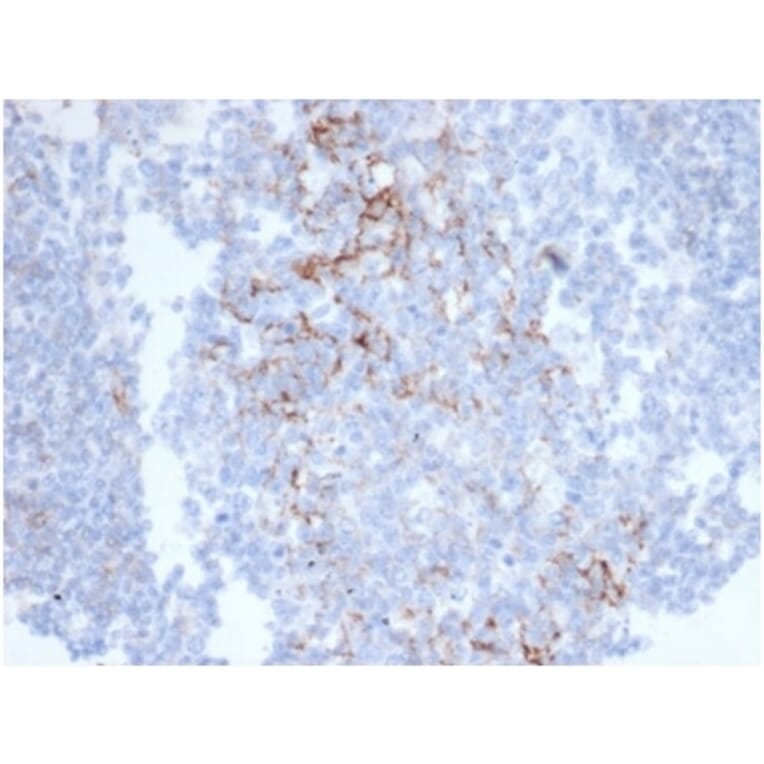 Immunohistochemistry - Anti-CD23 Antibody [FCER2/6890] - BSA and Azide free (A278185) - Antibodies.com