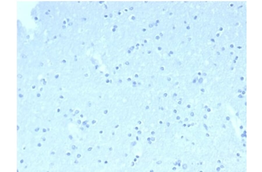Immunohistochemistry - Anti-CD23 Antibody [FCER2/6890] - BSA and Azide free (A278185) - Antibodies.com