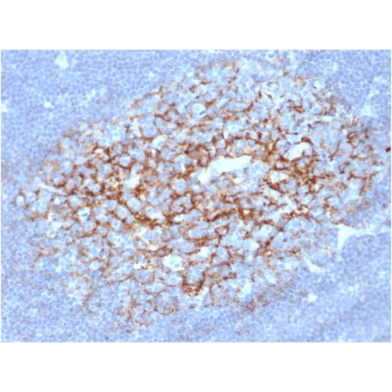 Immunohistochemistry - Anti-CD23 Antibody [FCER2/6891] - BSA and Azide free (A278186) - Antibodies.com