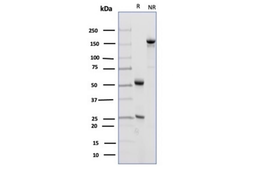 SDS-PAGE - Anti-CD23 Antibody [FCER2/4918] - BSA and Azide free (A278188) - Antibodies.com