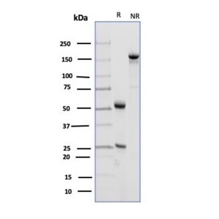 SDS-PAGE - Anti-CD23 Antibody [FCER2/4918] - BSA and Azide free (A278188) - Antibodies.com