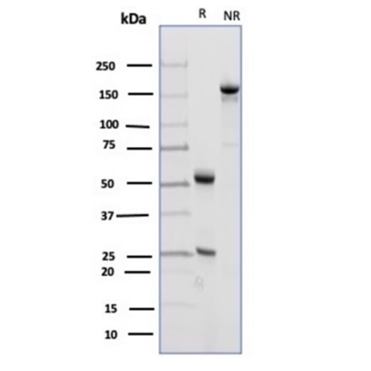 SDS-PAGE - Anti-CD23 Antibody [FCER2/4918] - BSA and Azide free (A278188) - Antibodies.com