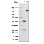 SDS-PAGE - Anti-CD23 Antibody [FCER2/4918] - BSA and Azide free (A278188) - Antibodies.com