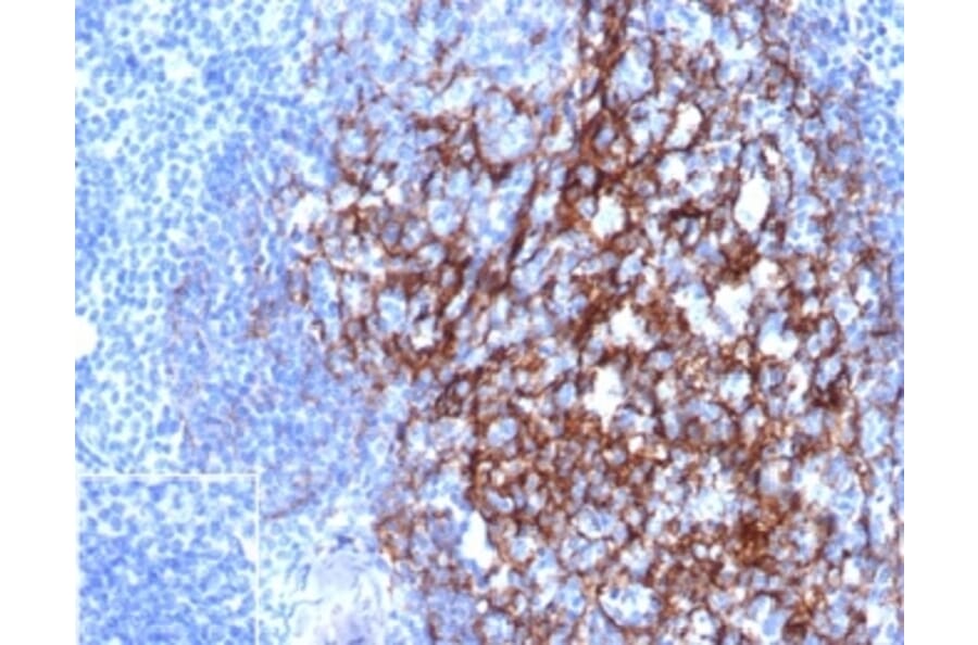 Immunohistochemistry - Anti-CD23 Antibody [FCER2/4918] - BSA and Azide free (A278188) - Antibodies.com