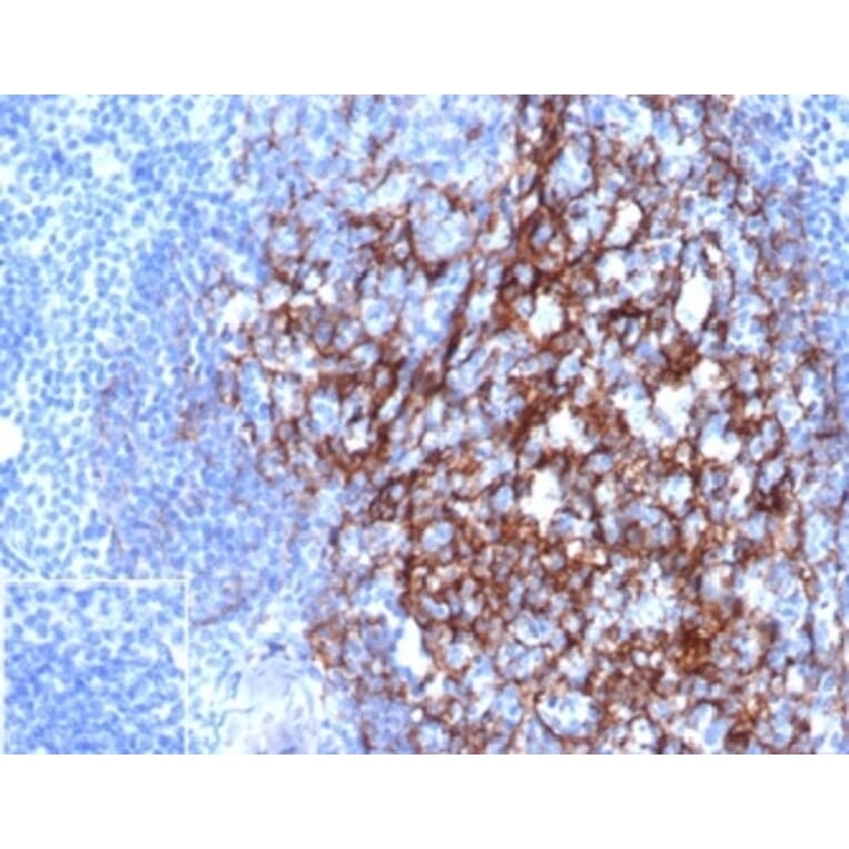 Immunohistochemistry - Anti-CD23 Antibody [FCER2/4918] - BSA and Azide free (A278188) - Antibodies.com