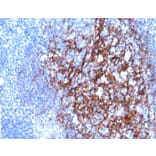 Immunohistochemistry - Anti-CD23 Antibody [FCER2/4918] - BSA and Azide free (A278188) - Antibodies.com