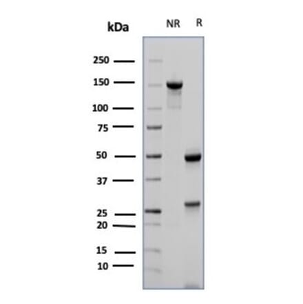 SDS-PAGE - Anti-CD23 Antibody [FCER2/6887] - BSA and Azide free (A278189) - Antibodies.com
