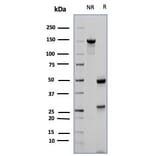 SDS-PAGE - Anti-CD23 Antibody [FCER2/6887] - BSA and Azide free (A278189) - Antibodies.com