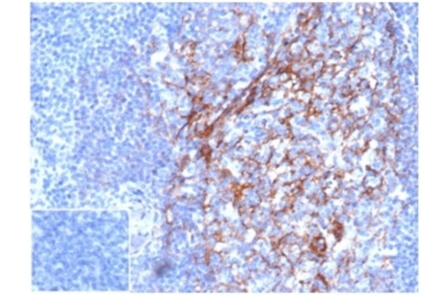 Immunohistochemistry - Anti-CD23 Antibody [FCER2/6887] - BSA and Azide free (A278189) - Antibodies.com