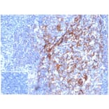 Immunohistochemistry - Anti-CD23 Antibody [FCER2/6887] - BSA and Azide free (A278189) - Antibodies.com