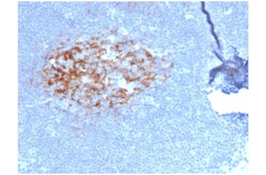 Immunohistochemistry - Anti-CD23 Antibody [FCER2/6887] - BSA and Azide free (A278189) - Antibodies.com