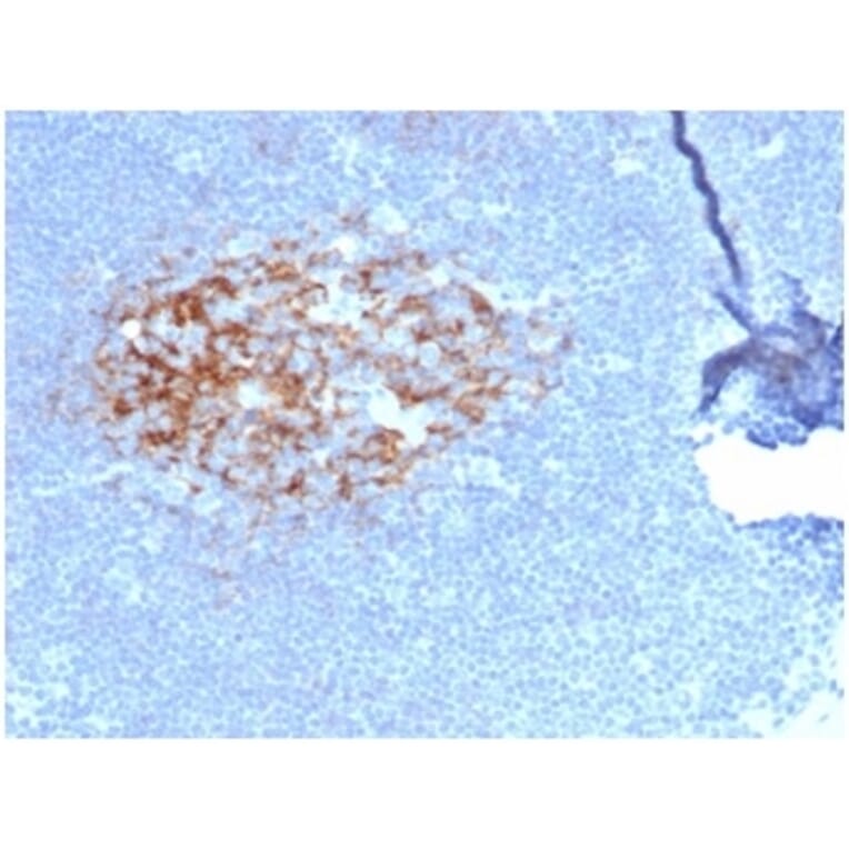 Immunohistochemistry - Anti-CD23 Antibody [FCER2/6887] - BSA and Azide free (A278189) - Antibodies.com