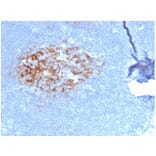 Immunohistochemistry - Anti-CD23 Antibody [FCER2/6887] - BSA and Azide free (A278189) - Antibodies.com