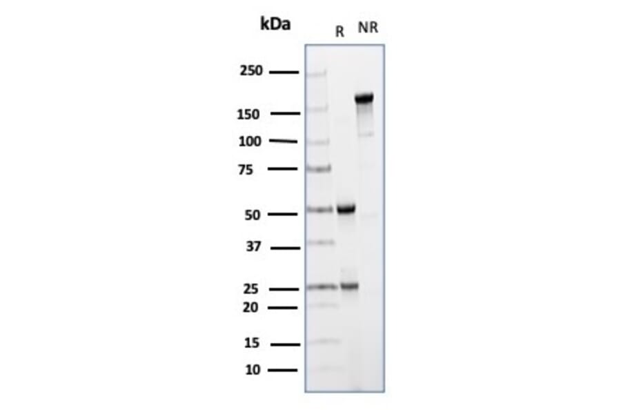 SDS-PAGE - Anti-CD64 Antibody [FCGR1A/4950] - BSA and Azide free (A278190) - Antibodies.com