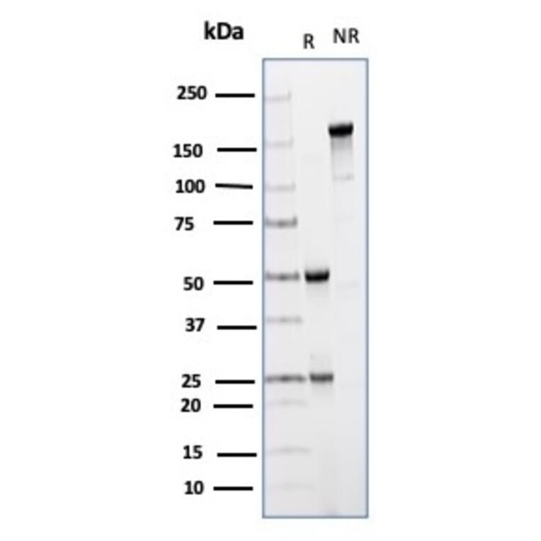 SDS-PAGE - Anti-CD64 Antibody [FCGR1A/4950] - BSA and Azide free (A278190) - Antibodies.com