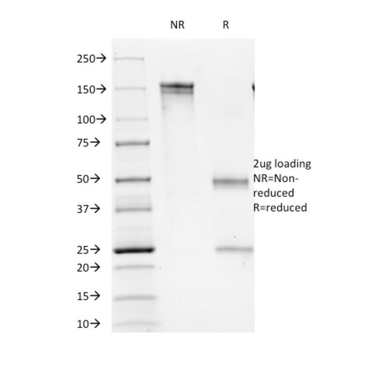 SDS-PAGE - Anti-CD16 Antibody [C16/1045] - BSA and Azide free (A278191) - Antibodies.com