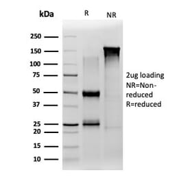SDS-PAGE - Anti-JAZF1 Antibody [PCRP-JAZF1-1C2] - BSA and Azide free (A278192) - Antibodies.com