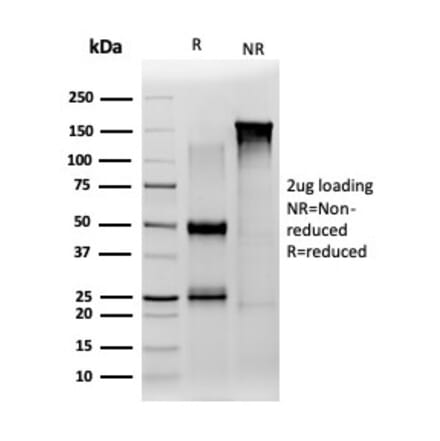 SDS-PAGE - Anti-JAZF1 Antibody [PCRP-JAZF1-1C2] - BSA and Azide free (A278192) - Antibodies.com