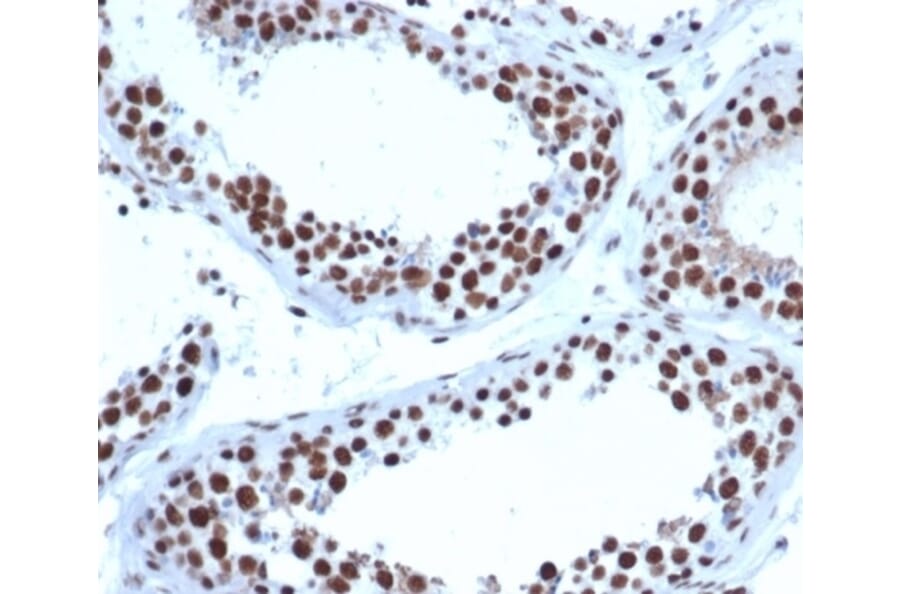 Immunohistochemistry - Anti-JAZF1 Antibody [PCRP-JAZF1-1C2] - BSA and Azide free (A278192) - Antibodies.com