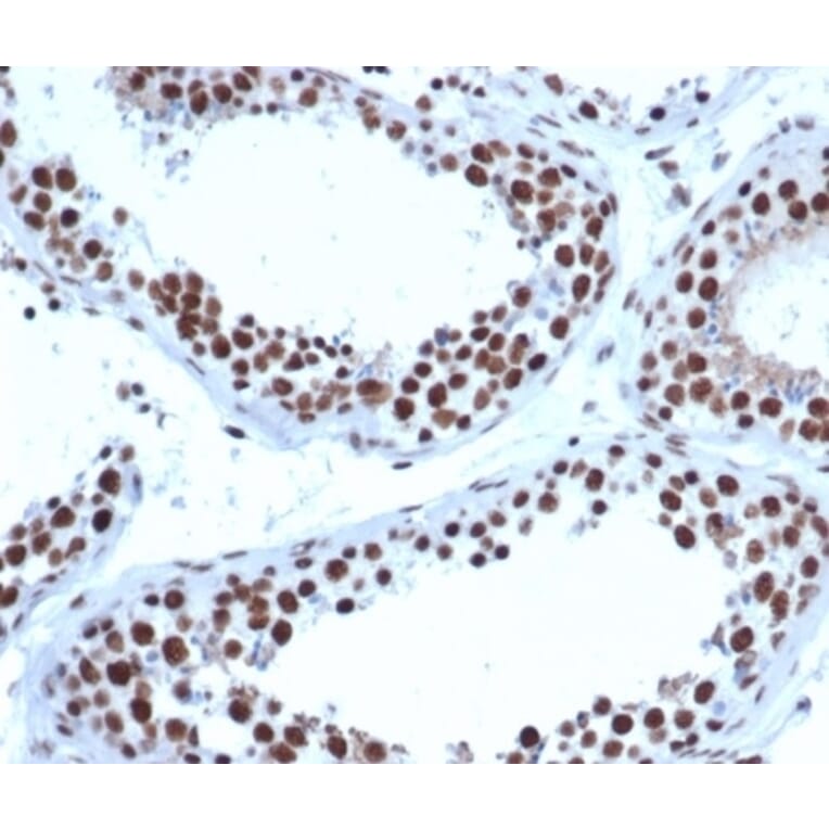 Immunohistochemistry - Anti-JAZF1 Antibody [PCRP-JAZF1-1C2] - BSA and Azide free (A278192) - Antibodies.com