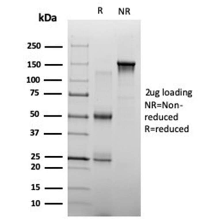 SDS-PAGE - Anti-ZHX3 Antibody [PCRP-ZHX3-1D11] - BSA and Azide free (A278194) - Antibodies.com