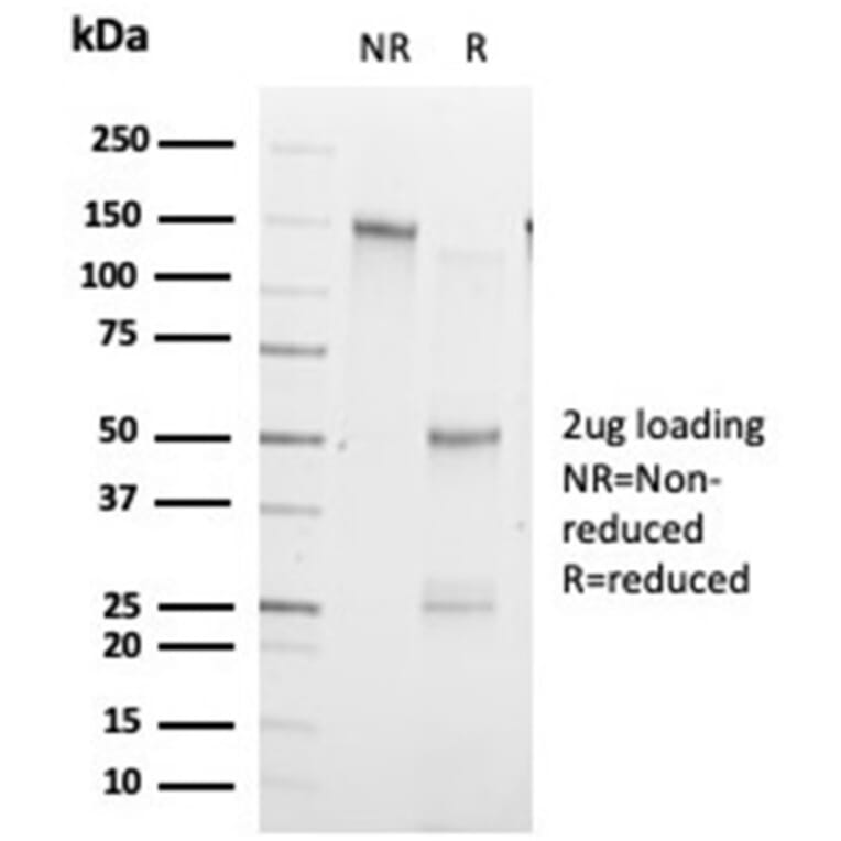 SDS-PAGE - Anti-ZHX3 Antibody [PCRP-ZHX3-1G3] - BSA and Azide free (A278195) - Antibodies.com