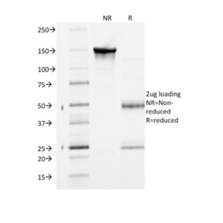 SDS-PAGE - Anti-VEGF Receptor 1 Antibody [FLT1/1663] - BSA and Azide free (A278199) - Antibodies.com