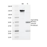 SDS-PAGE - Anti-VEGF Receptor 1 Antibody [FLT1/1663] - BSA and Azide free (A278199) - Antibodies.com
