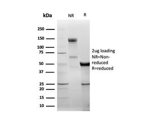 SDS-PAGE - Anti-DBC2 Antibody [DBC2/3361] - BSA and Azide free (A278200) - Antibodies.com