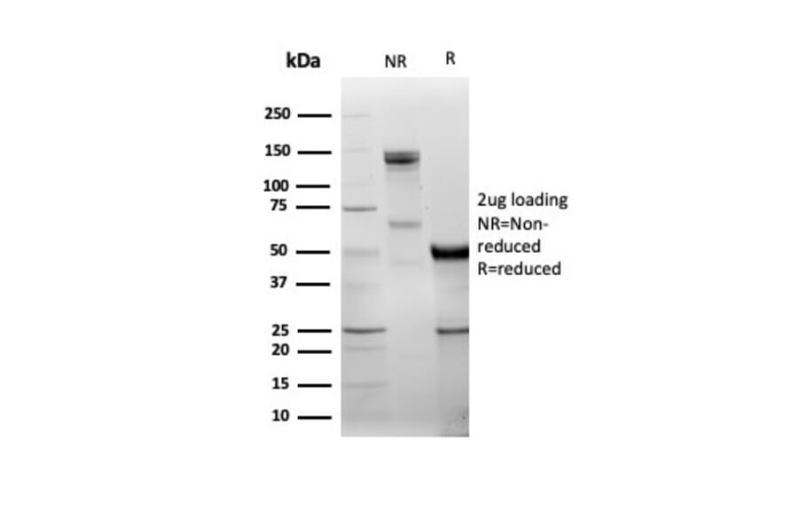 SDS-PAGE - Anti-DBC2 Antibody [DBC2/3361] - BSA and Azide free (A278200) - Antibodies.com