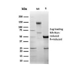 SDS-PAGE - Anti-DBC2 Antibody [DBC2/3361] - BSA and Azide free (A278200) - Antibodies.com