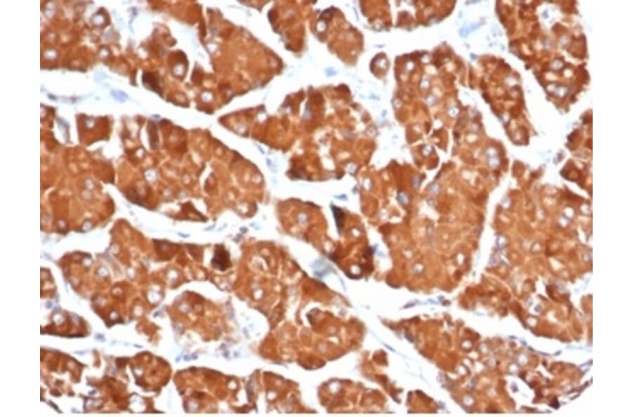 Immunohistochemistry - Anti-DBC2 Antibody [DBC2/3361] - BSA and Azide free (A278200) - Antibodies.com