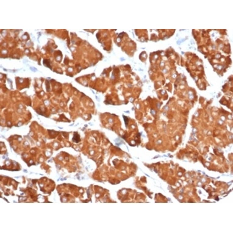 Immunohistochemistry - Anti-DBC2 Antibody [DBC2/3361] - BSA and Azide free (A278200) - Antibodies.com